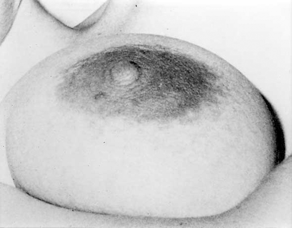 Breast - Click Image to Close